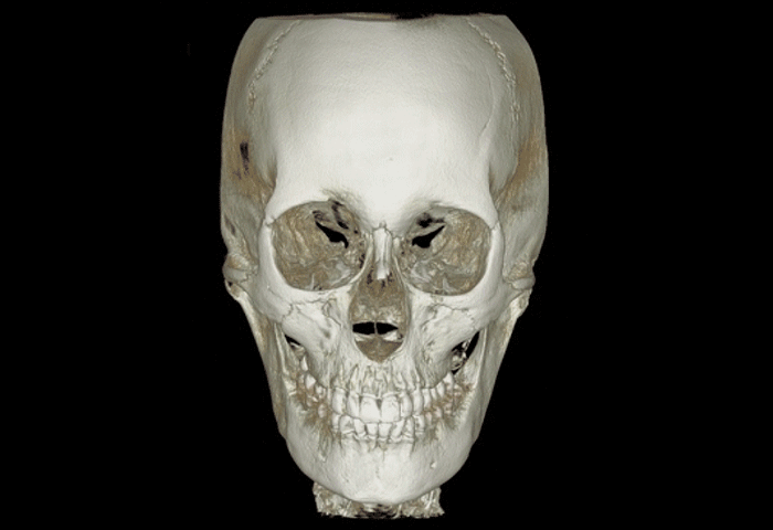 2105632051 64f0416658eb7 Sub0203 Crop