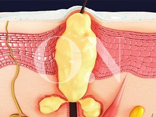 2105632051 657a9ce0d2508 Edit 3661049391 64f1be7ba106c Pdteab3bceca095 1