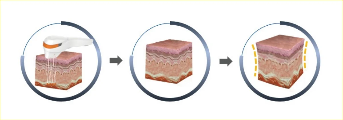 2105632051 642cee3699aec Ec8b9cec88a0ec9b90eba6ac