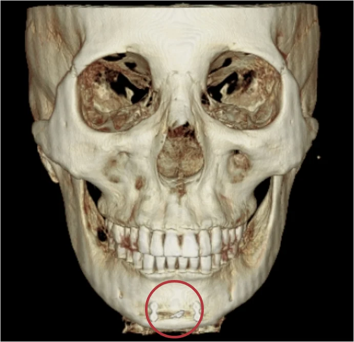 2105632051 6507f728e19f5 Eab7b8eba3b9 868