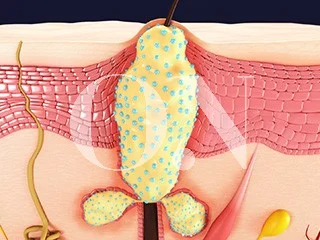 2105632051 657a9cef86fac Edit 3661049391 64f1be819bef7 Pdteab3bceca095 2