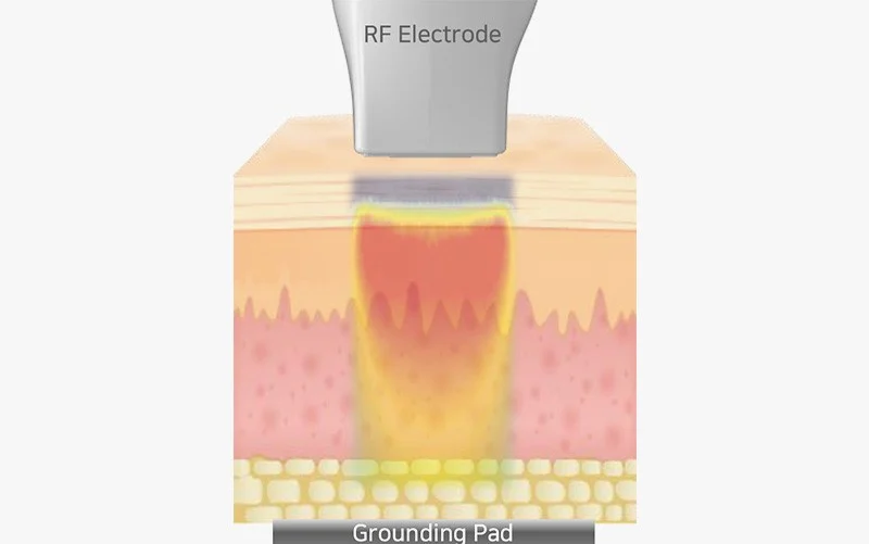 2105632051 639c10f7e99f1 Ec98aceba6aceca780ec98a4 Ec8b9cec88a0ec9b90eba6ac 03