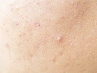 2105632051 8qxvls9v 01eba9b4ed8facec84b1