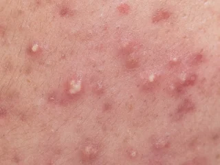 2105632051 Uxhmberi 03ed9994eb868dec84b1