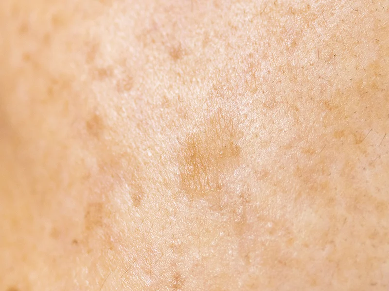 2105632051 Xc7ynvc6 Ec9ea1ed8bb0