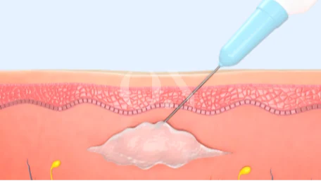 3697191616 6721c9c6180d8 Edit 2105632051 64faed364c9b3 Ed9584eb9fac002