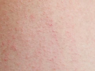 2105632051 I7gxcfw9 08ebaaa8eb82adec97bc