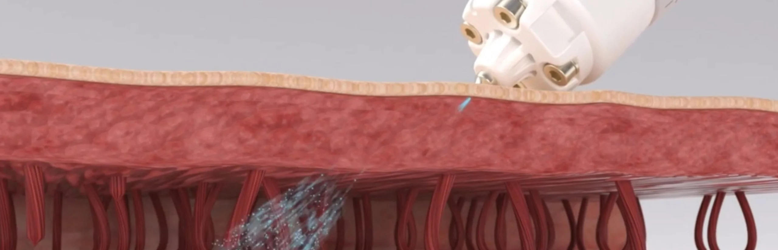 2105632051 Pfsvshut Ed8ab9eca795 Bg V3