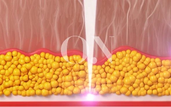 2105632051 657c0ee29fbce Edit 2105632051 657bfd7742b1a Eab8b0eca1b4ecb488ec9d8ced8c8c