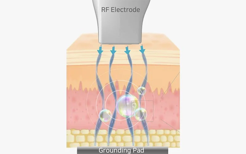 2105632051 639c10ea9ef84 Ec98aceba6aceca780ec98a4 Ec8b9cec88a0ec9b90eba6ac 01
