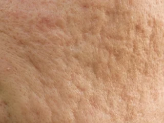 2105632051 Bk3d29h5 07ecbc88eba19cec9db4eb939cec84b1