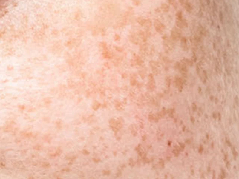 2105632051 Cxhfx2bc Eca3bceab7bceab9a8 1