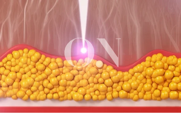 2105632051 657c0ef6534e3 Edit 2105632051 657bfd8213b9e Ec868ced9484ec9ba8ec9db4ebb88cecb488ec9d8ced8c8c