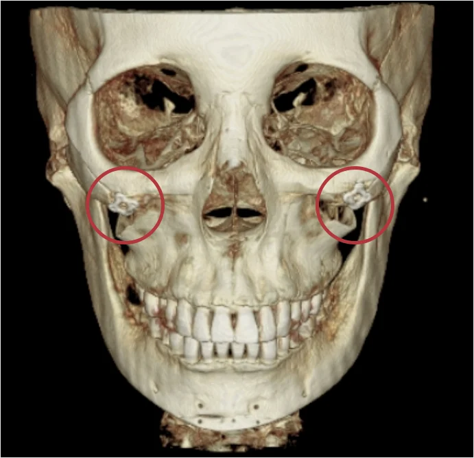 2105632051 6507f7317b9bf Eab7b8eba3b9 869