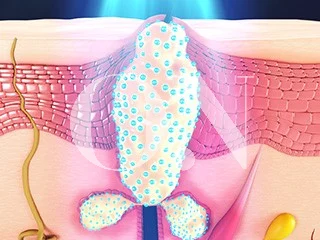 2105632051 657a9cfdcc6a6 Edit 3661049391 64f1be88355a8 Pdteab3bceca095 3