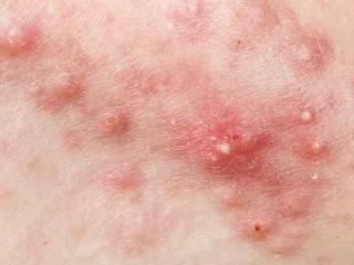 2105632051 9om7ozea 05eb82adeca285ec84b1