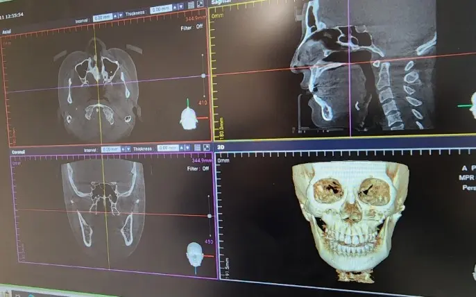 2105632051 6578067461548 Ec8b9cec8aa4ed859c 1