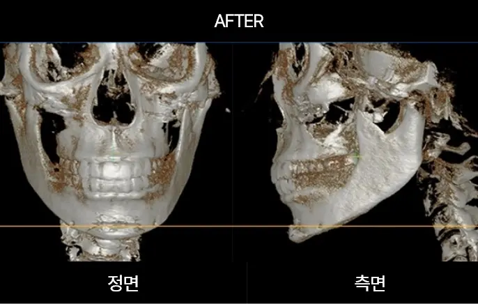 2105632051 6578110ba580b Ecbc80ec9db4ec8aa43 2