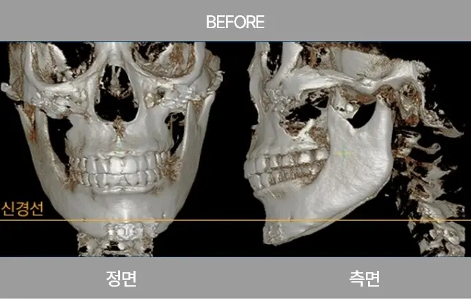 2105632051 65780b8c7bb1e Ecbc80ec9db4ec8aa43 1