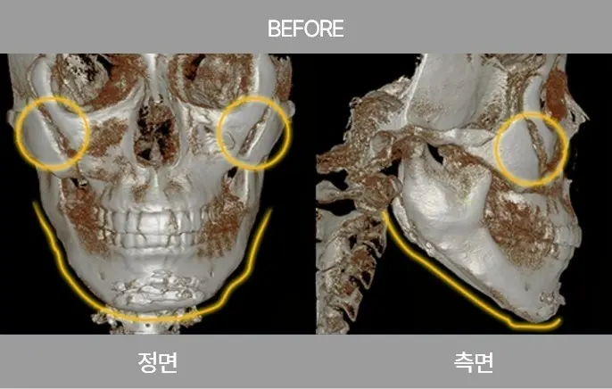 2105632051 65780df97efd2 Ecbc80ec9db4ec8aa42 1