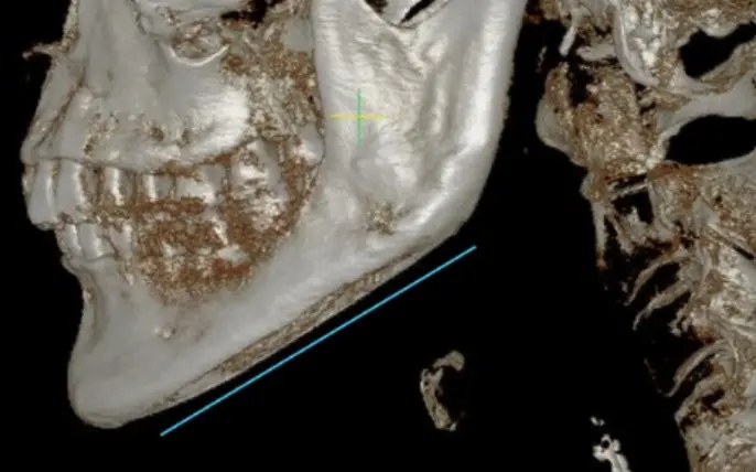 2105632051 6577ce42b4bb1 Ec9db4ebafb8eca780 076