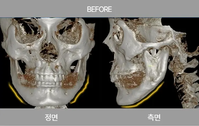 2105632051 65780b99d6020 Ecbc80ec9db4ec8aa41 1