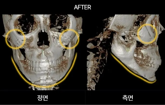 2105632051 65780e0284450 Ecbc80ec9db4ec8aa42 2