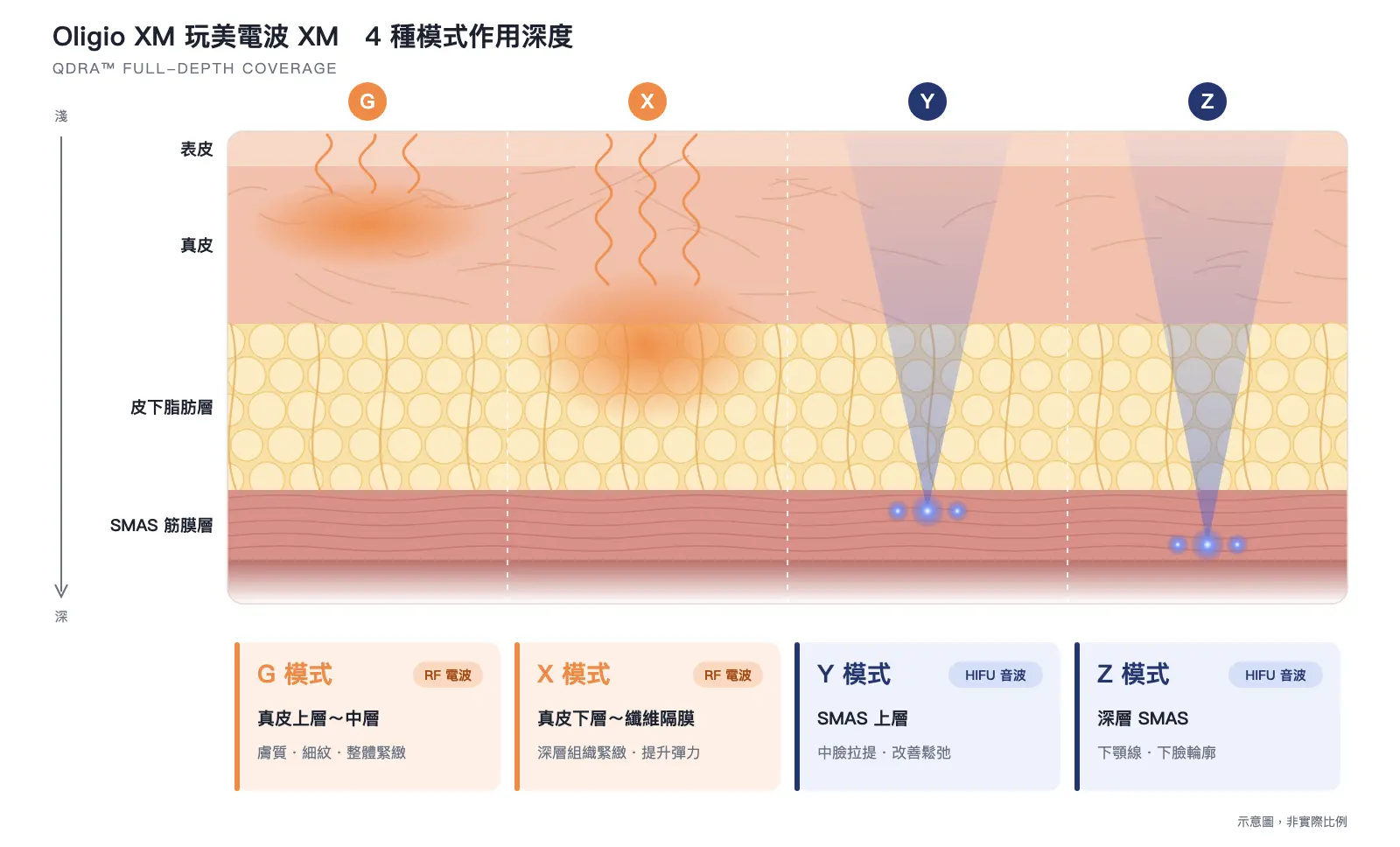 Oligio XM 4 種模式作用深度示意圖：G、X 模式為 RF 電波，作用在真皮；Y、Z 模式為 HIFU 音波，聚焦在 SMAS 筋膜層
