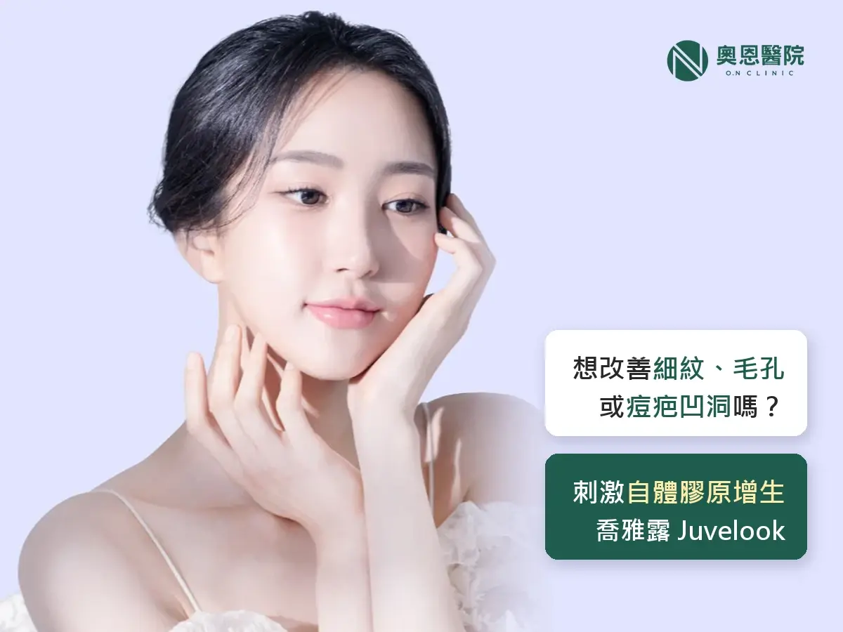 喬雅露 Juvelook 膠原增生療程，模特兒雙手托臉