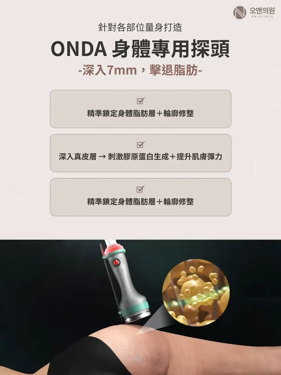 ONDA 身體專用探頭,用於手臂、腹部、大腿等身體局部脂肪