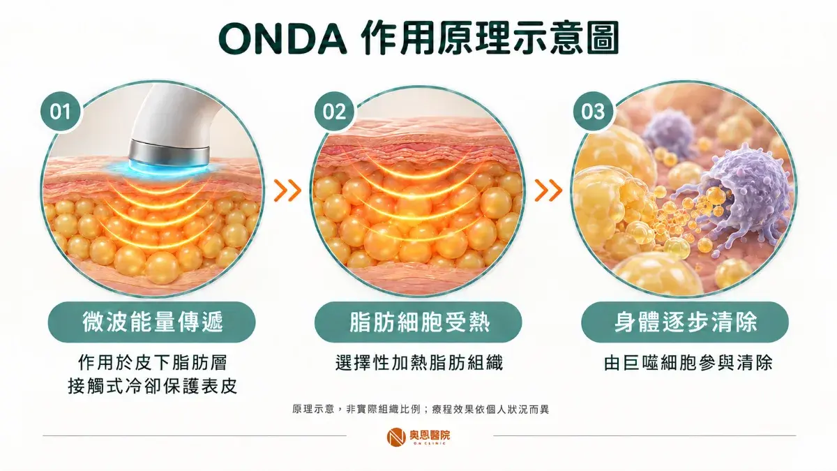 Onda 01